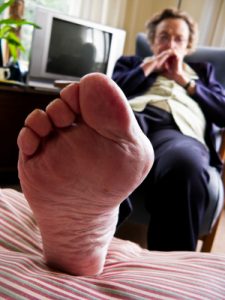 Man's Foot with Gout
