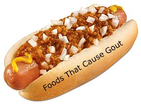 Chili Dog with Mustard and Onions