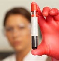 Lab Blood Testing