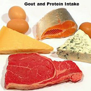 Gout and Protein Intake